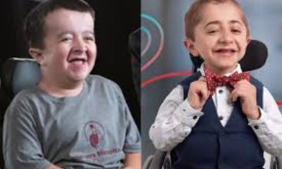 Do Alec and Kaleb Get Paid for Commercials? Unveiling the Truth Behind the Stars of Shriners Hospitals Ads