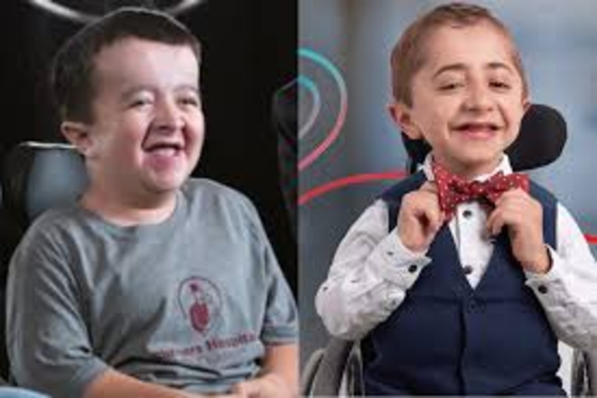 Do Alec and Kaleb Get Paid for Commercials? Unveiling the Truth Behind the Stars of Shriners Hospitals Ads